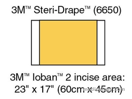 jual 3M Ioban 2 Drape Insisi 6650