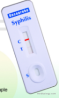 jual Oncoprobe Rapid Test Syphillis 25 Card/Box