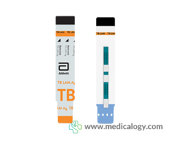 jual Rapid Test Determine TB LAM Ag SD Diagnostic 